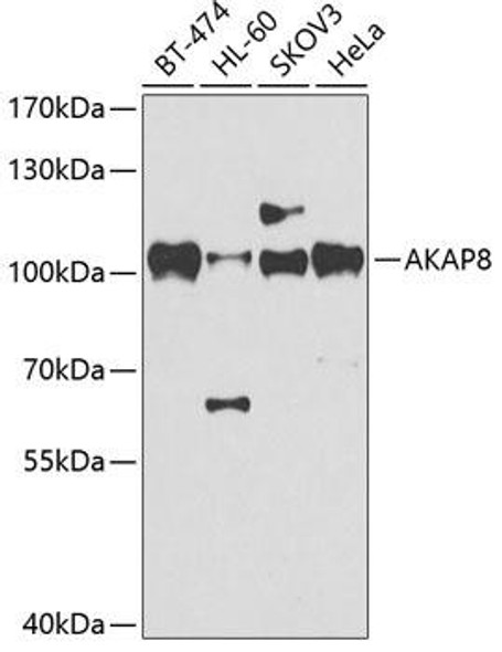 Anti-AKAP8 Antibody (CAB17302)