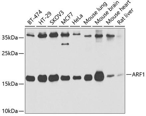 Anti-ARF1 Antibody (CAB2821)