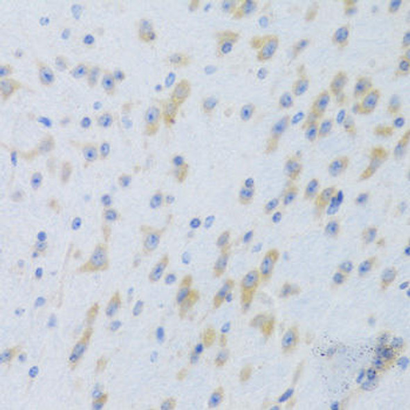Anti-TTR Antibody (CAB3186)