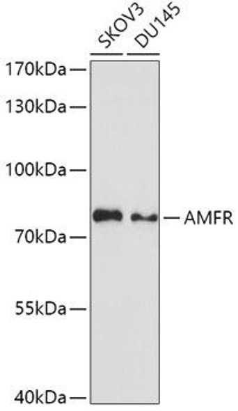 Anti-AMFR Antibody (CAB3731)