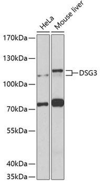 Anti-Desmoglein-3 Antibody (CAB8412)