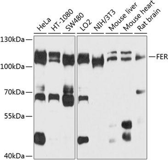 Anti-FER Antibody (CAB9687)