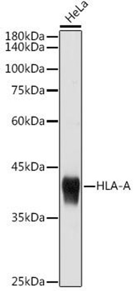 Anti-HLA-A Antibody (CAB17494)