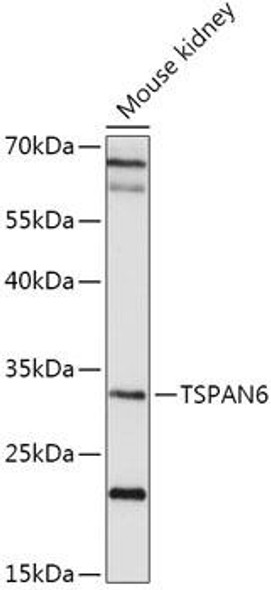 Anti-TSPAN6 Antibody (CAB17540)