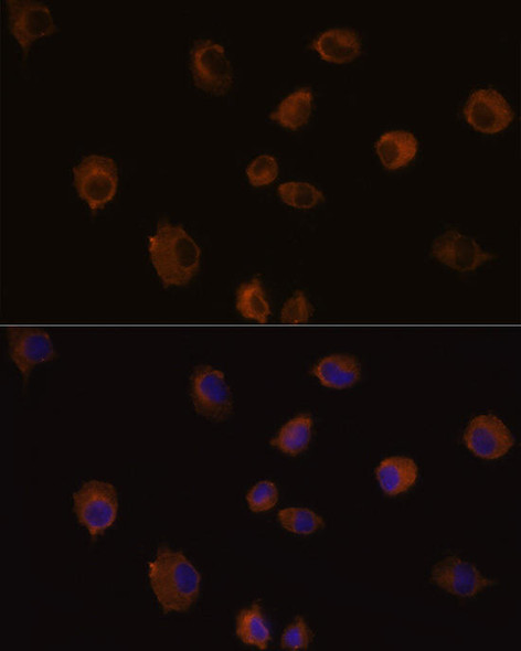 Anti-MMP13 Antibody (CAB11755)