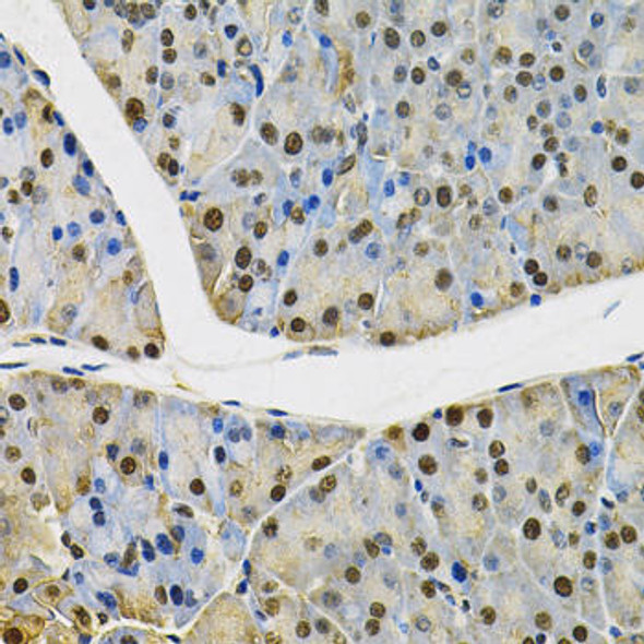 Anti-SKP1 Antibody (CAB12505)