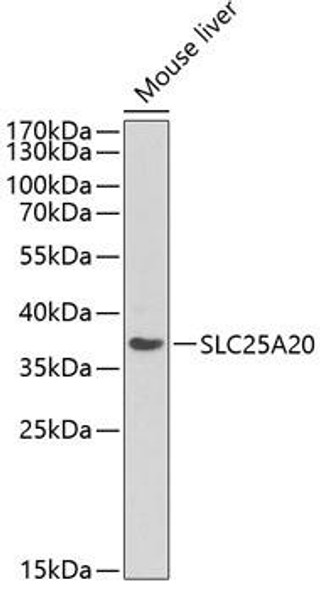Anti-SLC25A20 Antibody (CAB13956)