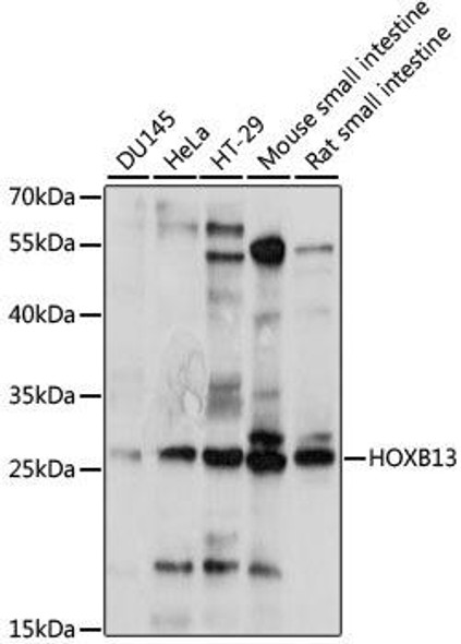 Anti-HOXB13 Antibody (CAB15779)