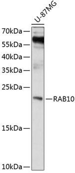 Anti-RAB10 Antibody (CAB4459)