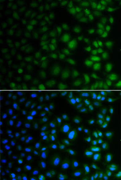 Anti-NAA40 Antibody (CAB7385)