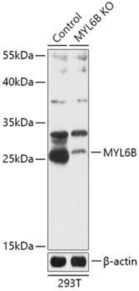 Anti-MYL6B Antibody (CAB18102)[KO Validated]