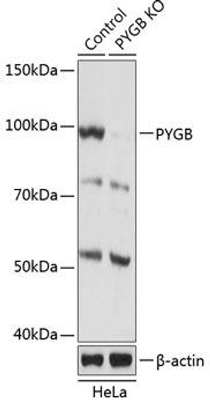 Anti-PYGB Antibody (CAB19910)[KO Validated]