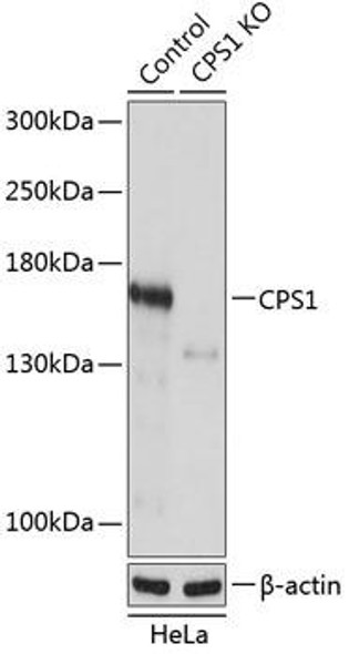 Anti-CPS1 Antibody (CAB19978)[KO Validated]