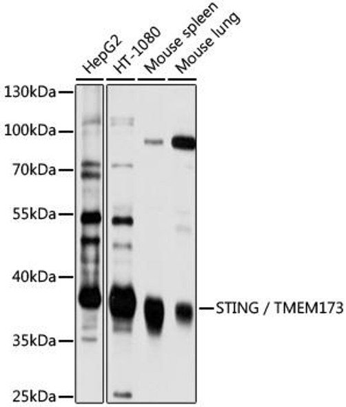 Anti-STING / TMEM173 Antibody (CAB3262)