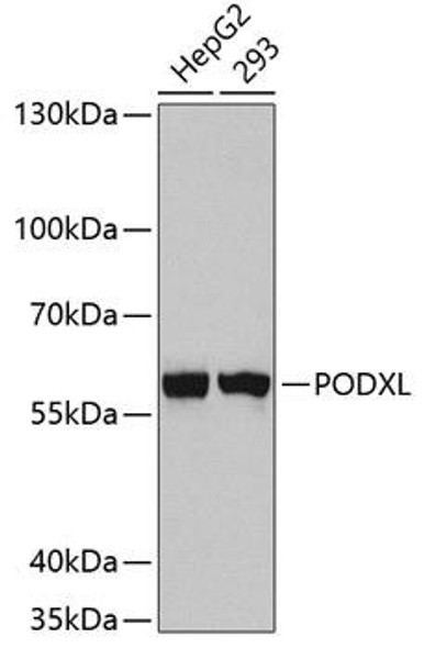 Anti-PODXL Mouse Monoclonal Antibody (CAB5911)