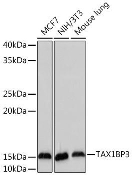 Anti-TAX1BP3 Antibody (CAB19793)