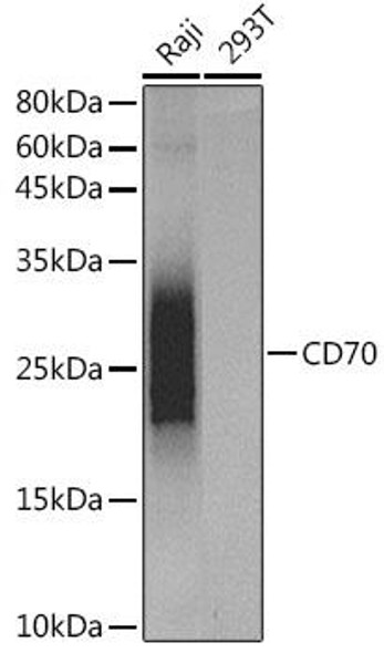 Anti-CD70 Antibody (CAB20589)