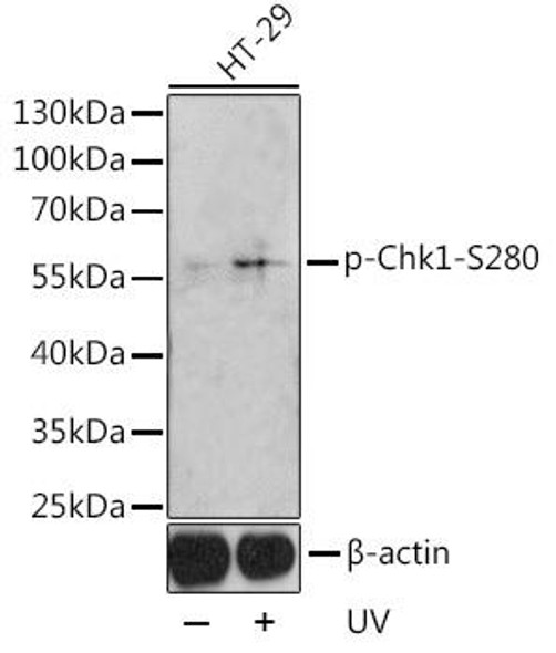 Anti-Phospho-CHEK1-S280 Antibody (CABP0017)