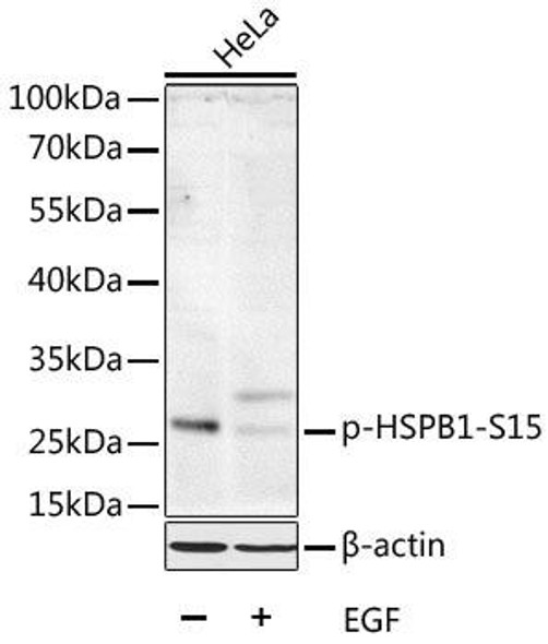 Anti-Phospho-HSPB1-S15 Antibody (CABP0040)