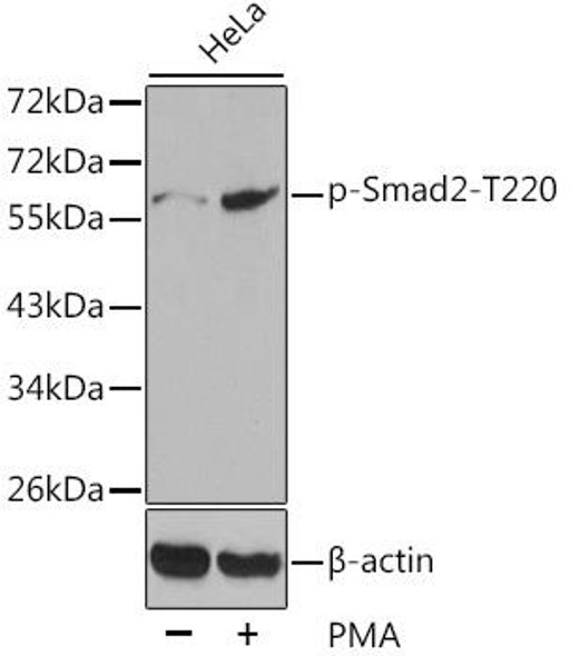 Anti-Phospho-SMAD2-T220 Antibody (CABP0270)