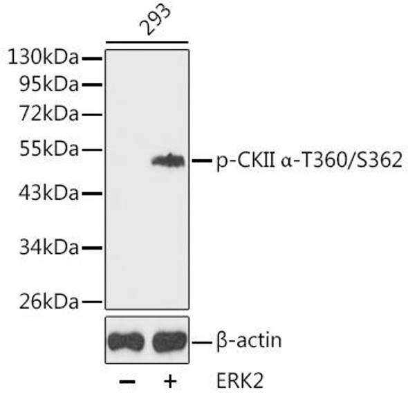 Anti-Phospho-CSNK2A1-T360/S362 Antibody (CABP0335)