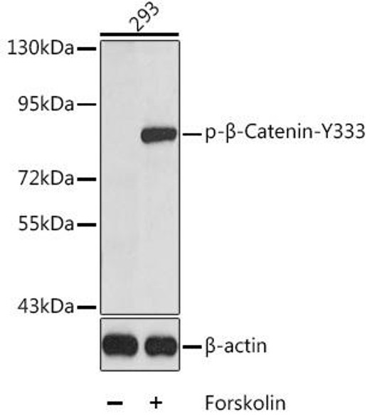 Anti-Phospho-Catenin beta-1-Y333 Antibody (CABP0337)