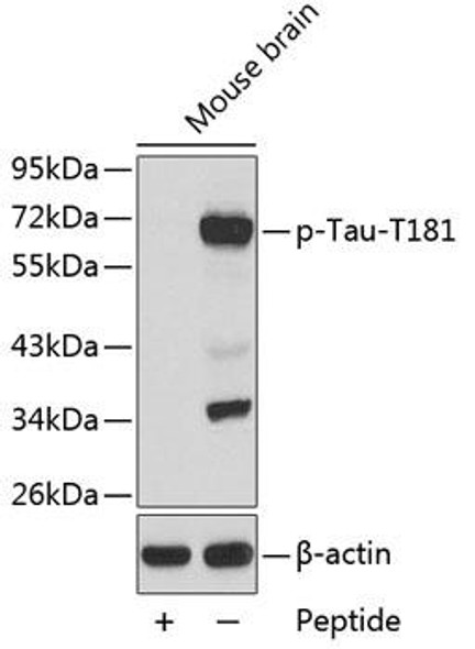 Anti-Phospho-MAPT-T181 Antibody (CABP0399)