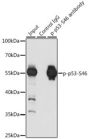 Anti-Phospho-p53-S46 Antibody (CABP0476)