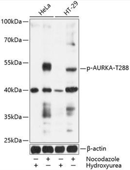 Anti-Aurora kinase A Antibody (CABP0523)