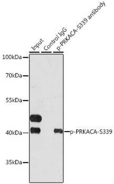 Anti-Phospho-PRKACA-S339 Antibody (CABP0558)