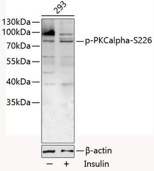 Anti-Phospho-PKCalpha-S226 Antibody (CABP0559)