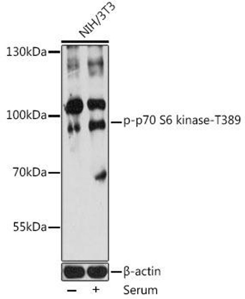 Anti-Phospho-P70S6K1-T389 Antibody (CABP0564)
