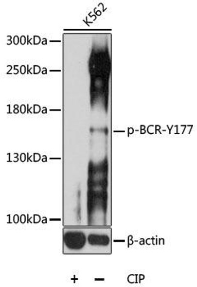 Anti-Phospho-BCR-Y177 Antibody (CABP0606)
