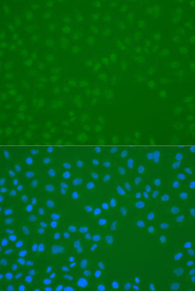 Anti-Phospho-CHEK1-S296 pAb Antibody (CABP0831)