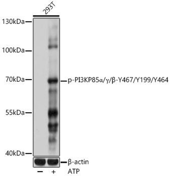 Anti-Phospho-PI3KP85 alpha/gamma/beta-Y467/Y199/Y464 pAb Antibody (CABP0854)