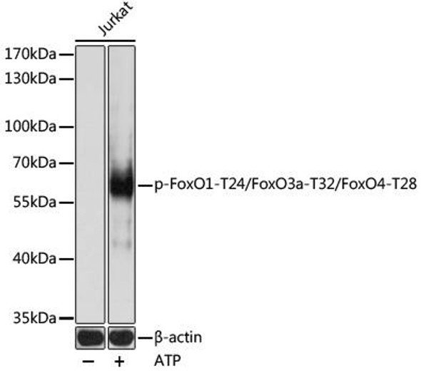 Anti-Phospho-FoxO1-T24/FoxO3a-T32/FoxO4-T28 pAb Antibody (CABP0892)