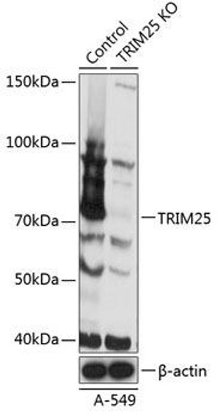 Anti-TRIM25 Antibody (CAB19887)[KO Validated]