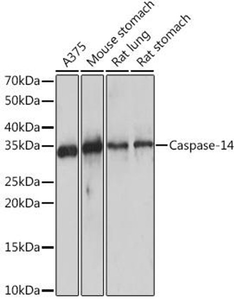 Anti-Caspase-14 Antibody (CAB9618)