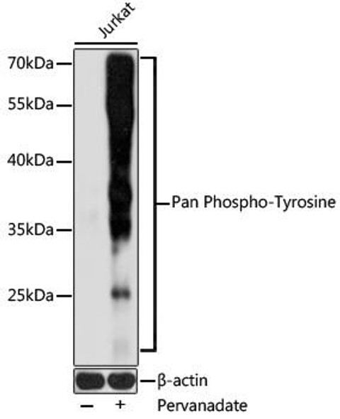Anti-Pan Phospho-Tyrosine Antibody (CABP0905)
