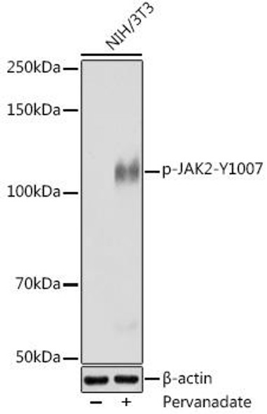 Anti-Phospho-JAK2-Y1007 Antibody (CABP0917)