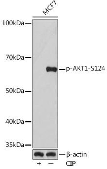 Anti-Phospho-AKT1-S124 Antibody (CABP0982)
