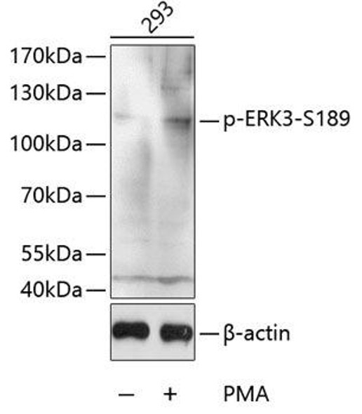 Anti-Phospho-ERK3-S189 Antibody (CABP0051)