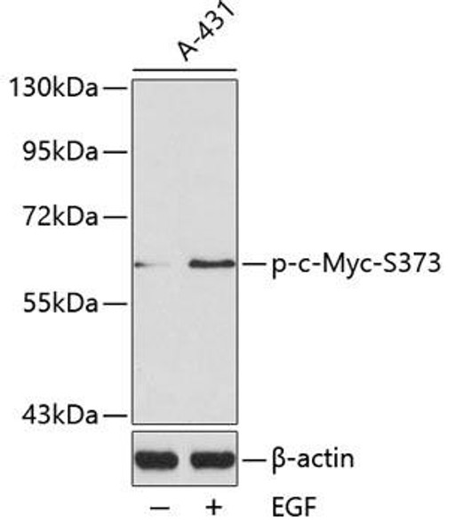 Anti-Phospho-MYC-S373 Antibody (CABP0132)