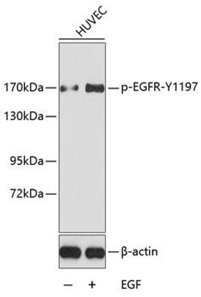 Anti-Phospho-EGFR-Y1197 Antibody (CABP0223)