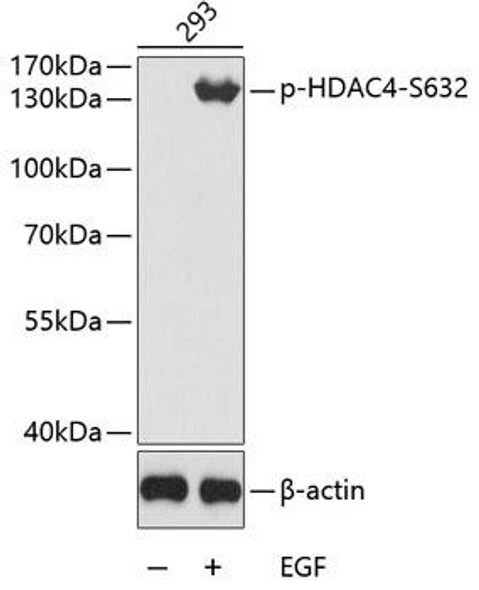 Anti-Phospho-HDAC4-S632 Antibody (CABP0359)