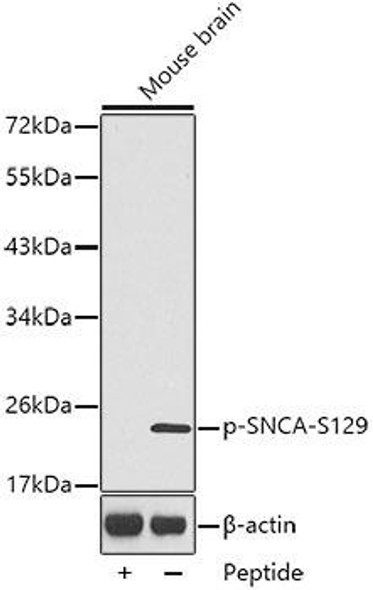 Anti-Phospho-Alpha-synuclein-S129 Antibody (CABP0450)
