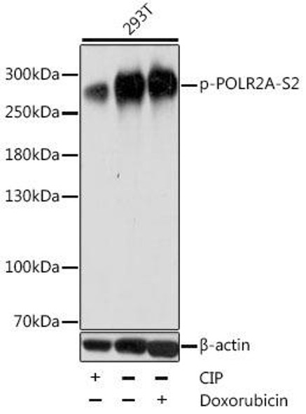 Anti-Phospho-POLR2A-S2 pAb Antibody (CABP0749)