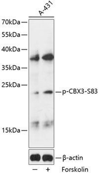 Anti-Phospho-CBX3-S83 pAb Antibody (CABP0801)