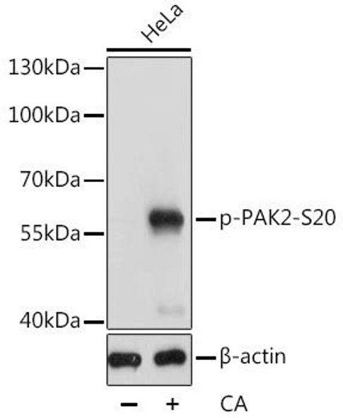Anti-Phospho-PAK2-S20 pAb Antibody (CABP0803)