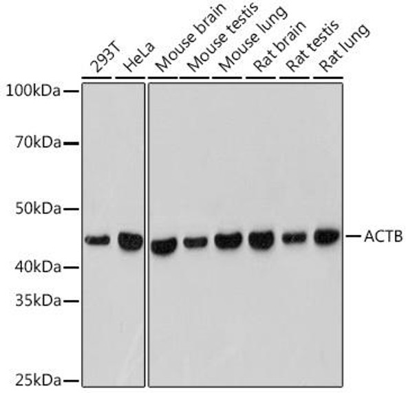 Anti-Beta Actin Antibody (CABC038)